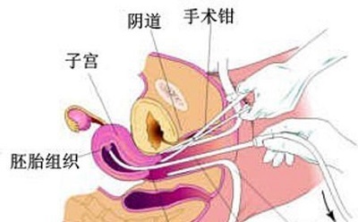 短效避孕药，哪个更好吃？