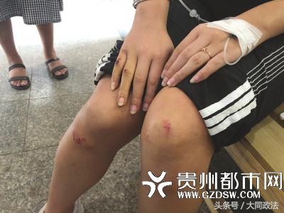 女乘客投诉深夜被快车司机拳打脚踢，滴滴客服：72小时回复