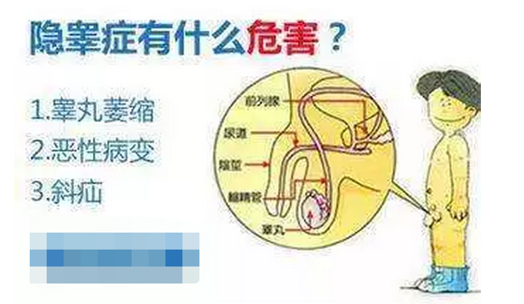 2岁宝宝先天睾丸“错位”，医生腹腔镜下手术送它“回家”