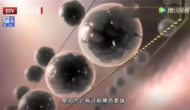这5种“痣”竟是潜在的“癌中之王”!快看看你身上有没有