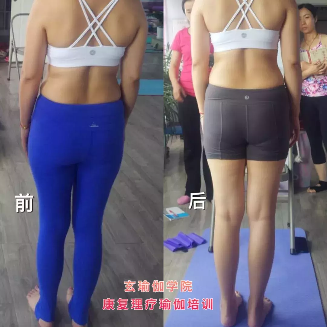 康复理疗瑜伽培训新技能：呼吸治腰疼