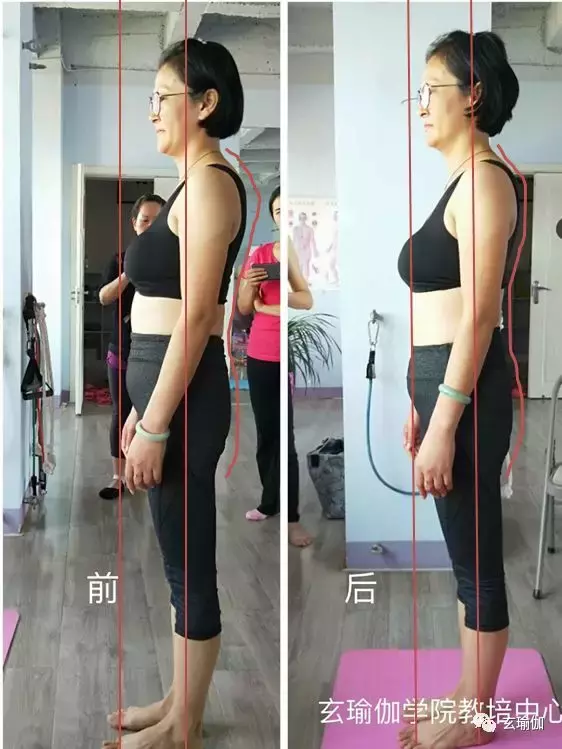 康复理疗瑜伽培训新技能：呼吸治腰疼