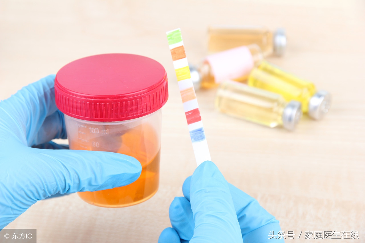 出现泡沫尿是身体生病了？静置几分钟，出现这个现象则无需担心