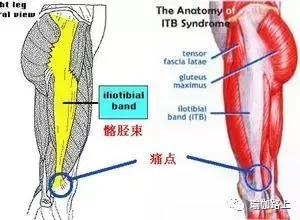 你的髂脛束太緊啦！等等，髂脛束是哪裡？