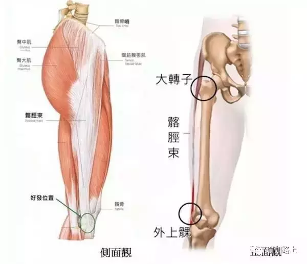 你的髂脛束太緊啦！等等，髂脛束是哪裡？