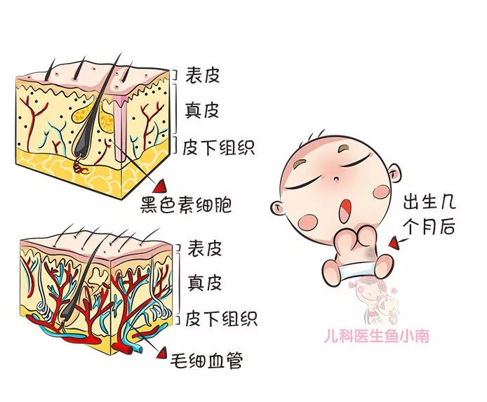 好胎记、坏胎记怎么分？宝宝的胎记如果长这样，一定要去看医生