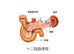 左金丸，用于慢性糜烂性胃炎、胆汁返流性胃炎、胃十二指肠溃疡