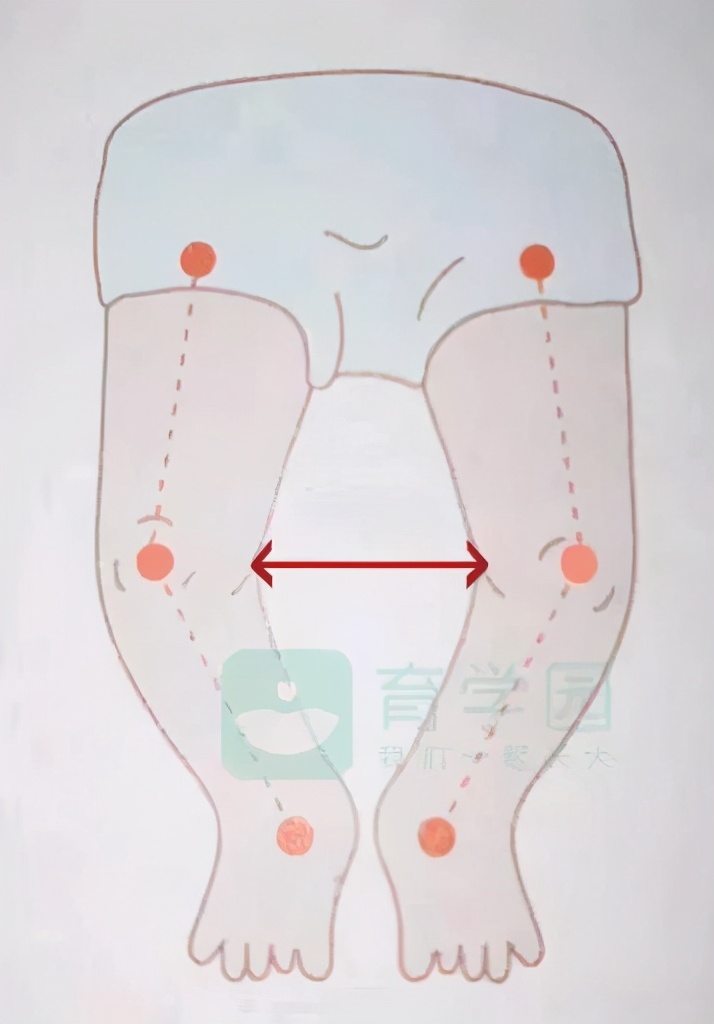 宝宝O型腿、X型腿和过早站有关？如何辨别、矫正？一篇讲明白