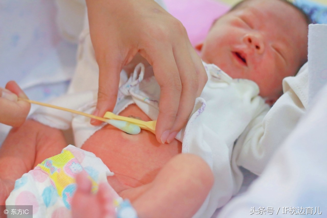 新生儿脐带应该怎么护理？5个护理须知，新手妈妈要牢记