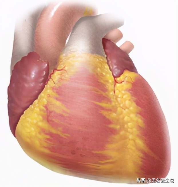 冠心病的解剖基礎——最全的冠脈血管圖解