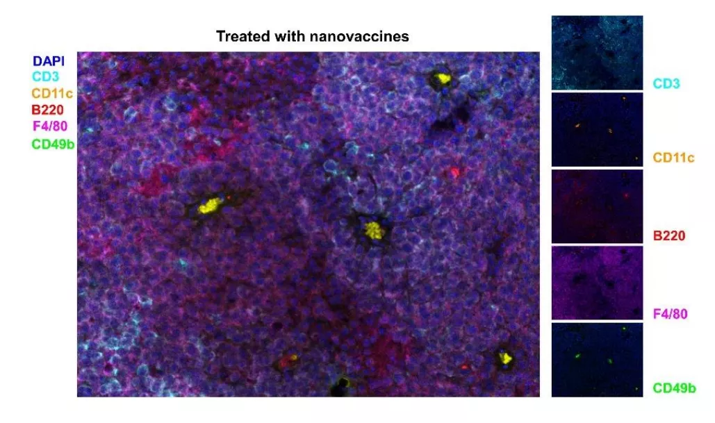 苏州大学用癌细胞重组纳米疫苗，8只受试鼠全部实现肺癌预防痊愈