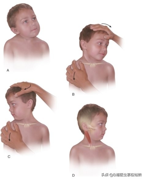 宝宝总是歪头，面向一侧，俗称“歪脖”，听说这叫斜颈，怎么办？