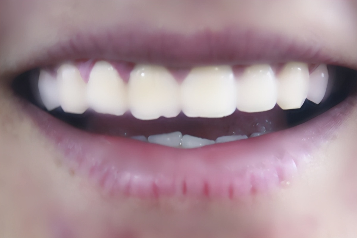 ϿٳġСʯͷֳֻʲôȥ
