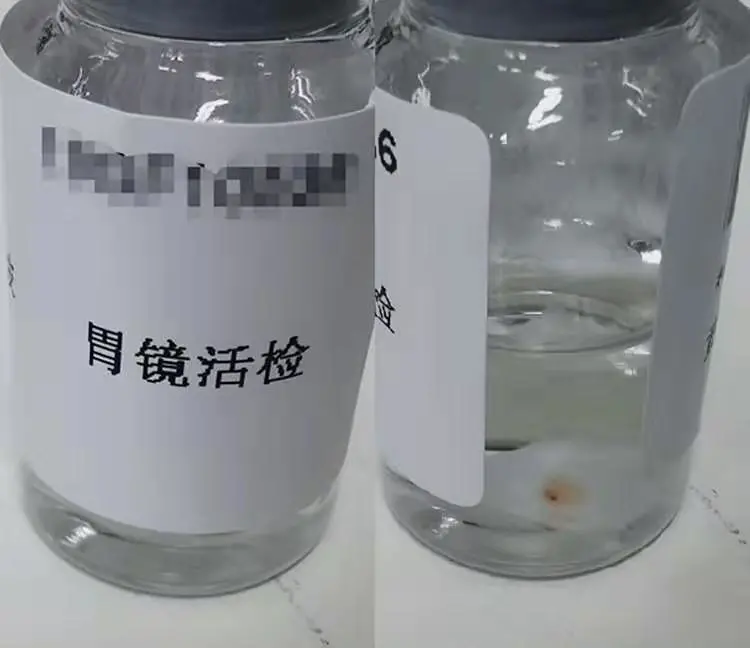 为什么我的活检报告和常规病理报告不一样?
