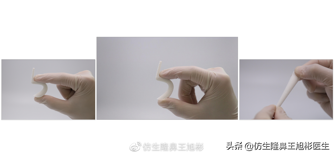 超肋,超体,人工骨,异体肋,自体肋材料怎么选,傻傻分不清楚?