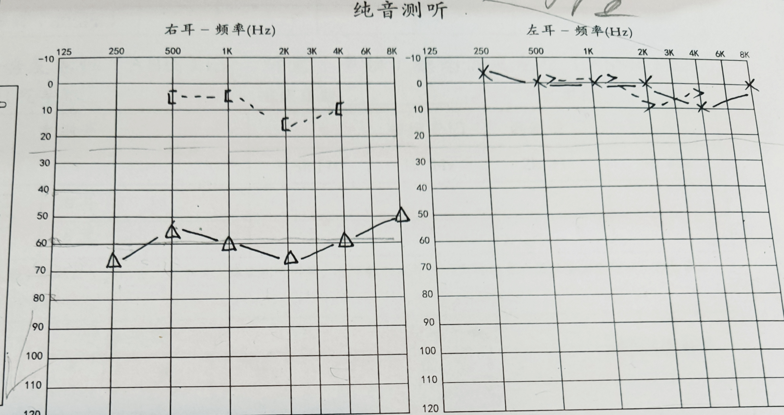 “小耳朵”让她自卑十一年，今春终于重拾自信