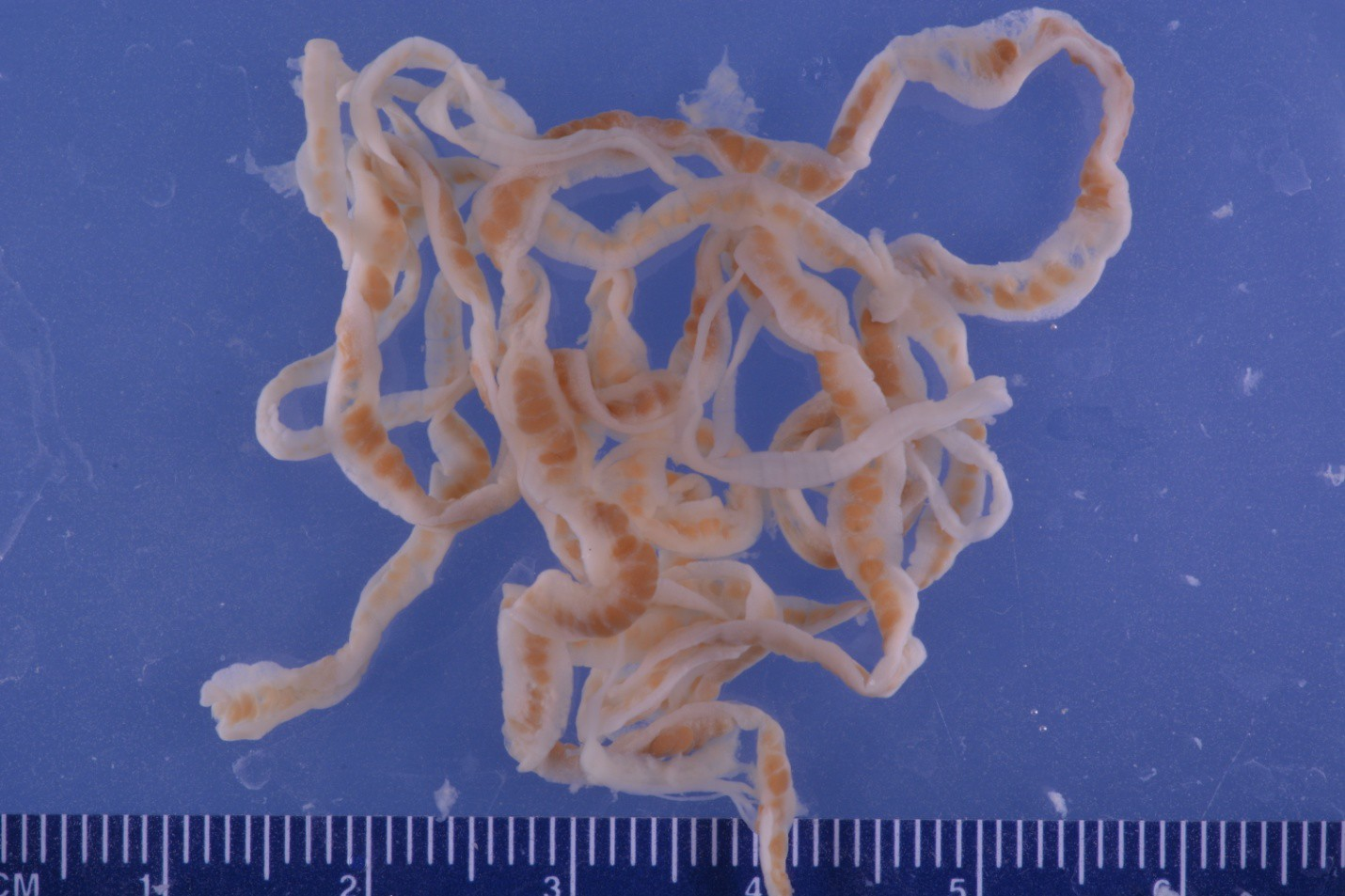 猪肉里面的寄生虫图片(10米绦虫) - 赤虎壹号