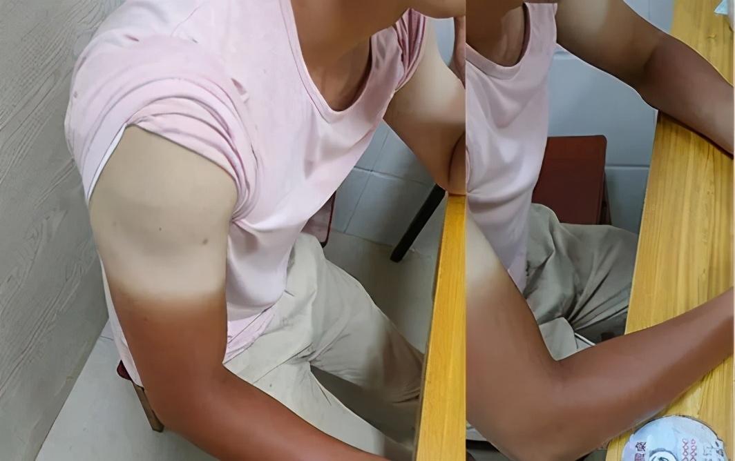 冰袖什么牌子好（5款不同品牌冰袖实测效果）