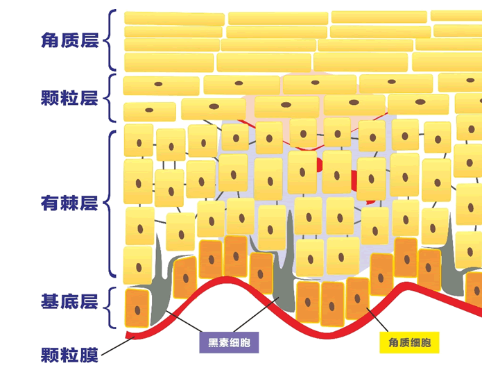 角质层薄怎么修复增厚，改善增厚角质层的办法