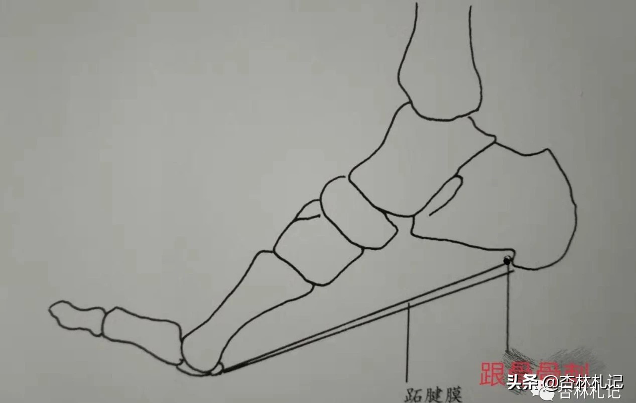 足底疼痛怎么办？找准原因是关键！