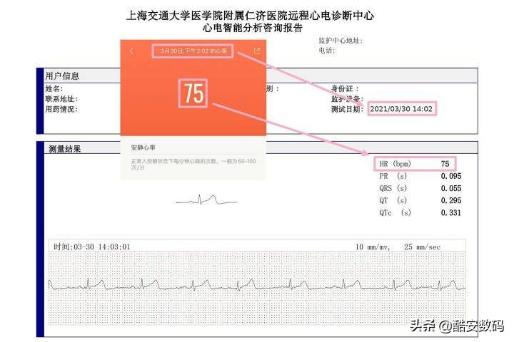 小米手环 6 NFC 上手：不是终点，更是起点