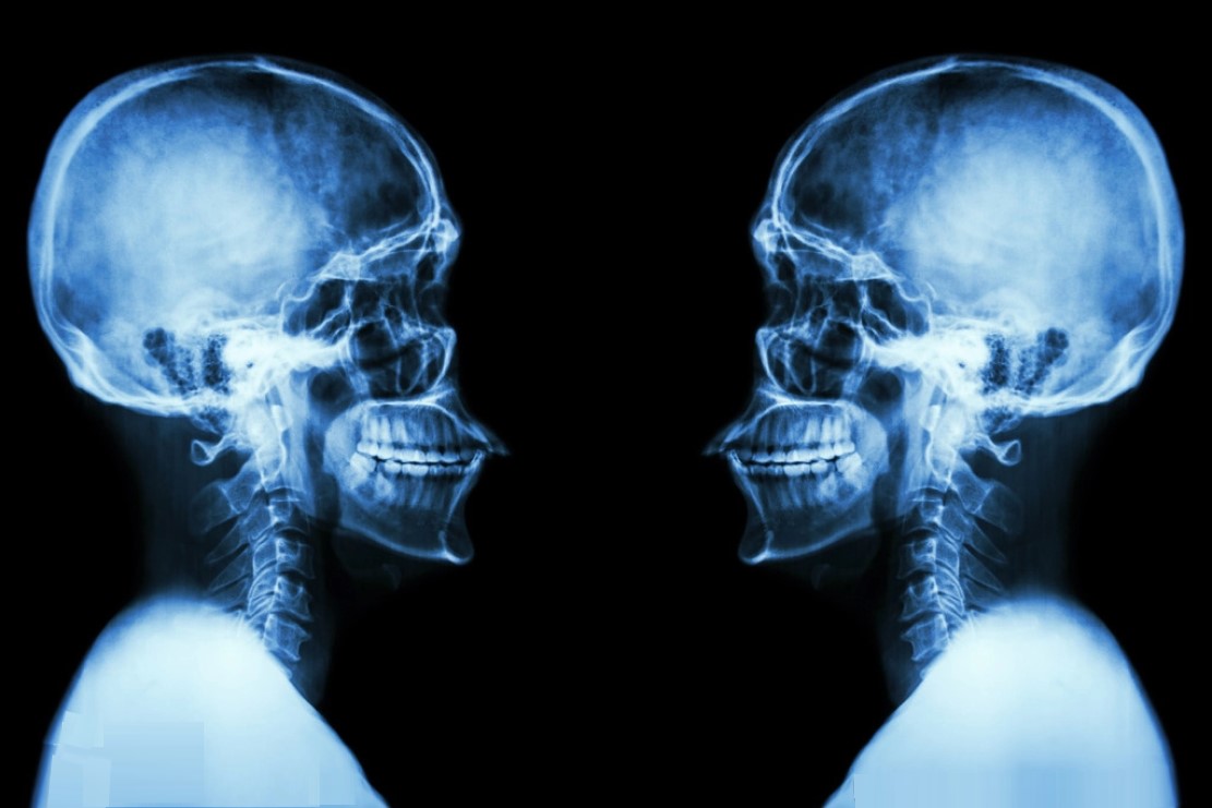 x身份指的是(什么是x射线,它是如何被发现的,对人类有多大影响?