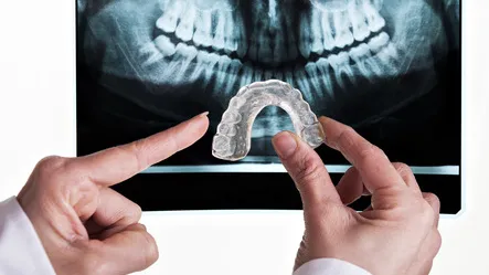 睡觉总磨牙，不仅伤牙还毁脸型！口腔医生给你3种解决方法