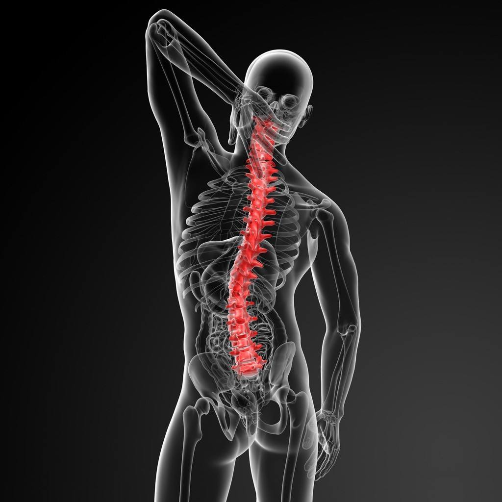 先天性脊柱側彎，患病原因不僅複雜，且臨床表現較嚴重，及時診治