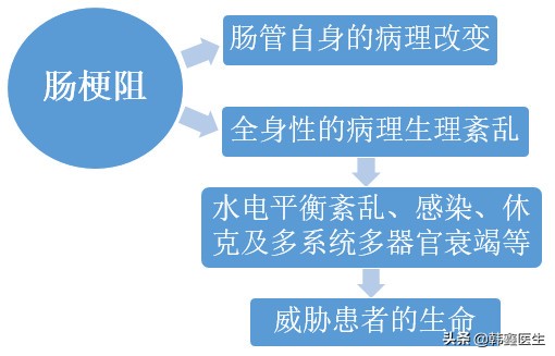 肠梗阻的诊断和治疗