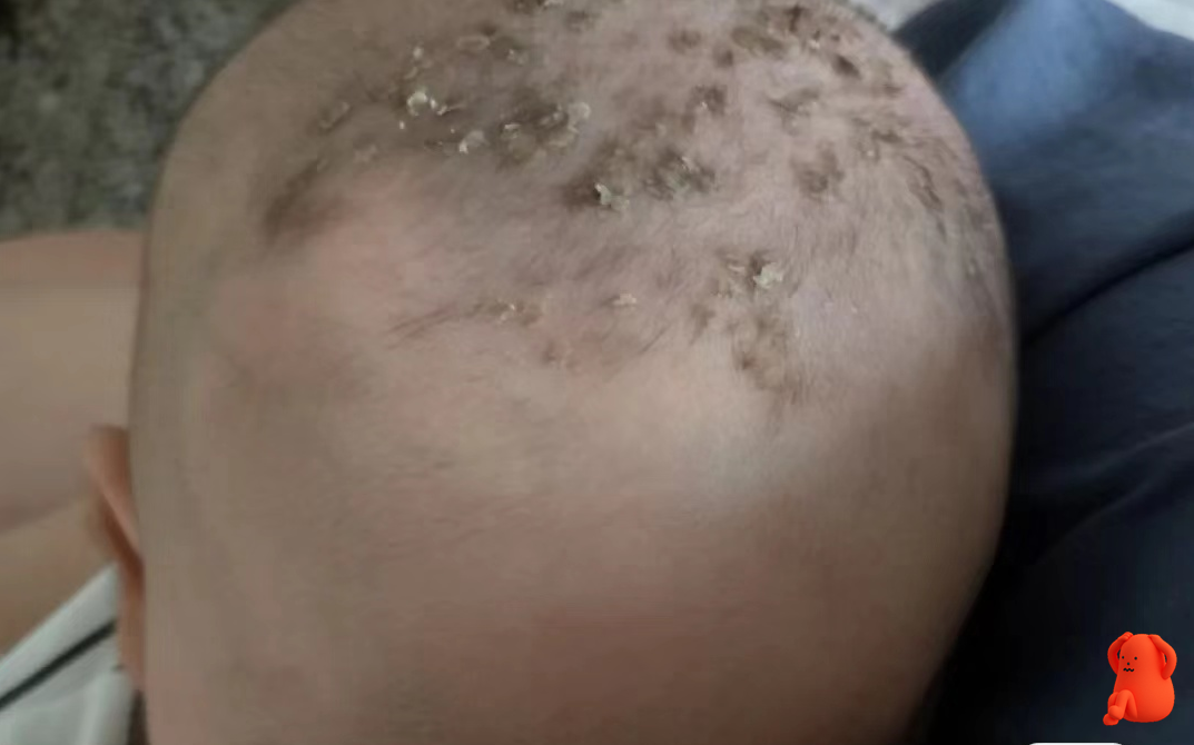 婴儿头上有道箍图片(有种) - 乐宝宝贝