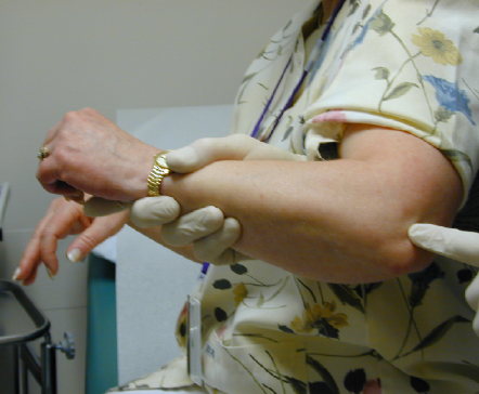 胳膊肘疼不能提重物拧毛巾？骨科医生告诉你有了「网球肘」怎么办