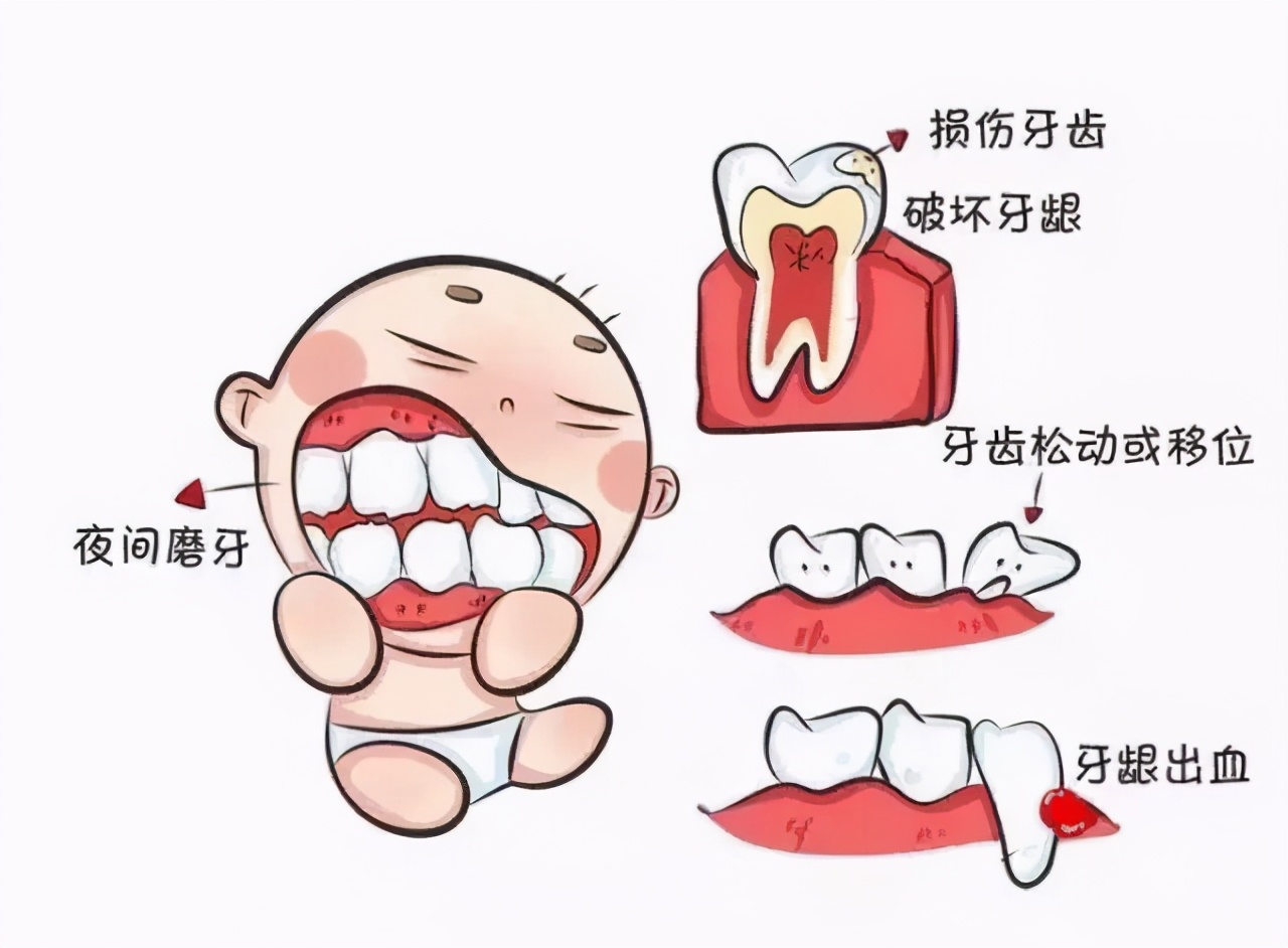 为什么宝宝睡觉总是磨牙?你以为是缺钙,其实有很多种可能