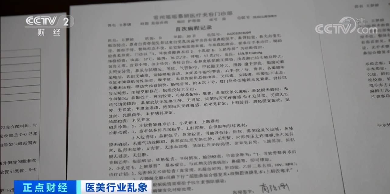 整容死亡,整容死亡的明星