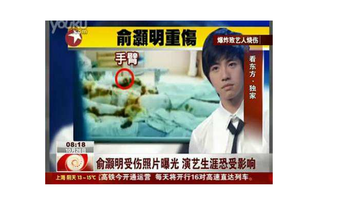 流量明星转型硬汉小生，俞灏明经历的不止一场大火