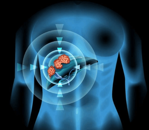 肝癌靶向药有哪些，国产、印度靶向药价格是多少？