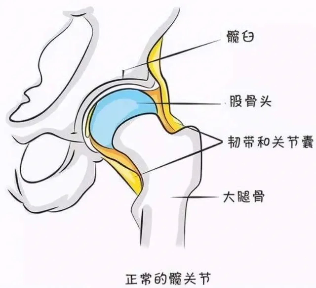 您的髋关节发育正常吗？4 个问题，带你认识髋关节发育不良