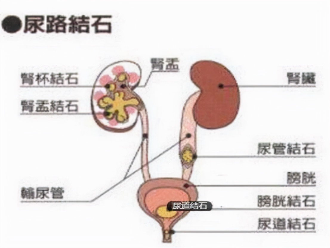 速效救心丸，你使用正确了吗？