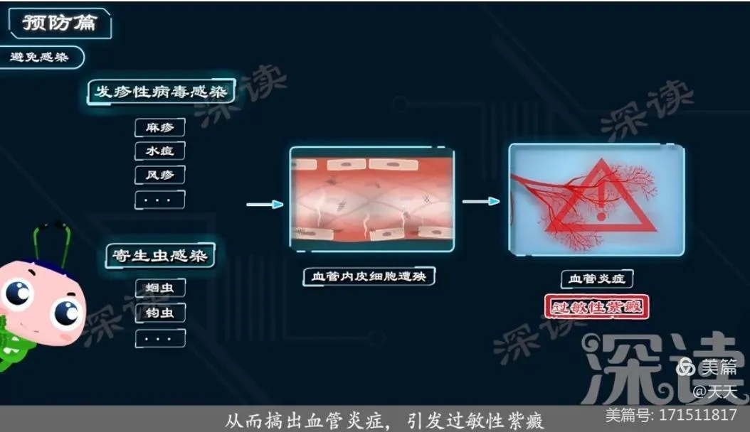 你知道过敏性紫癜吗？别急，看渭南市中医医院为您科普