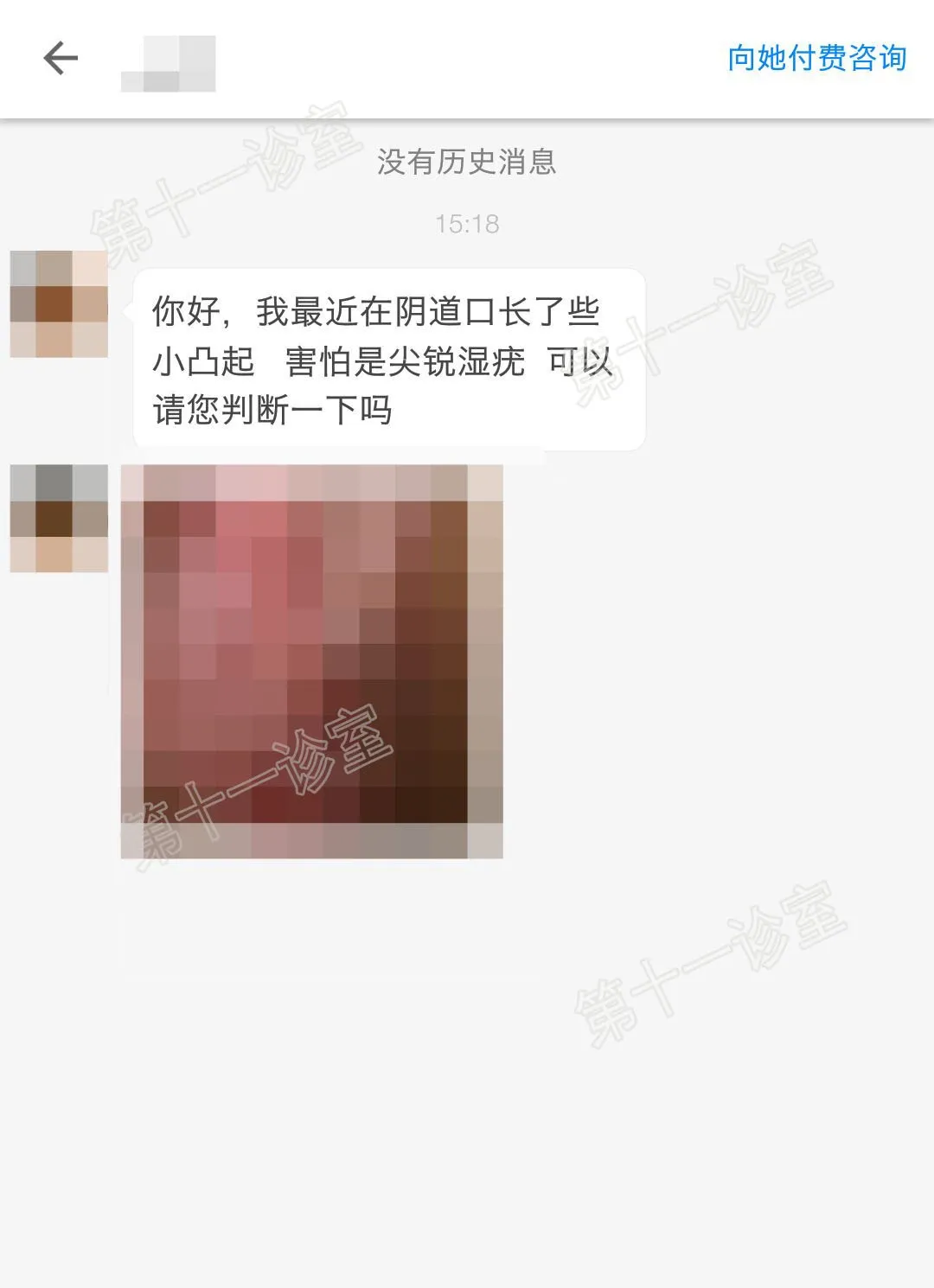 真人实验 | 下面长的尖锐湿疣和假性湿疣到底怎么区分？