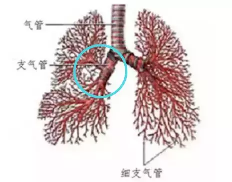 孩子咳嗽老不好，警惕得了支气管炎，应该这样护理