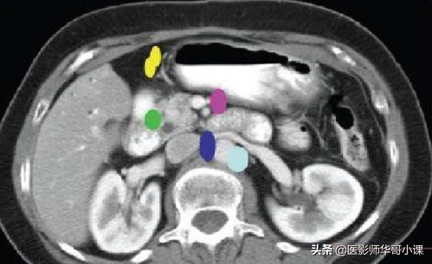 胃，3D立体重建技术，还您一个实实在在的胃。网友：价格多少呢