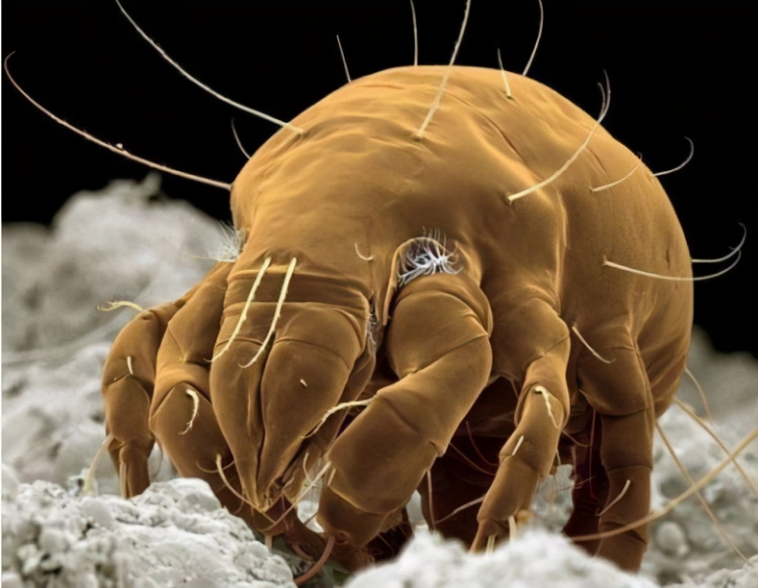 手上的细菌 图片显微镜(洗澡搓下来的黑泥究竟是什么) - 赤虎壹号