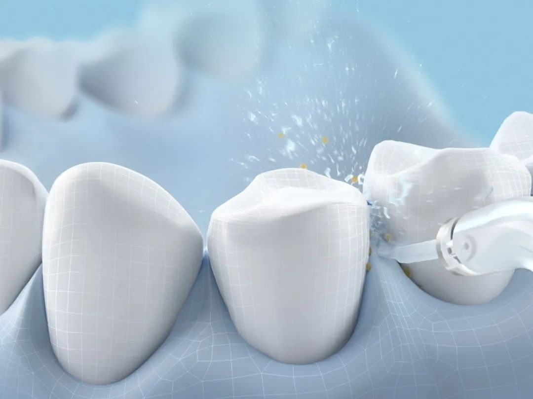 若舒糖果冲牙器体验，牙齿清洁强迫症，这次终于有救了