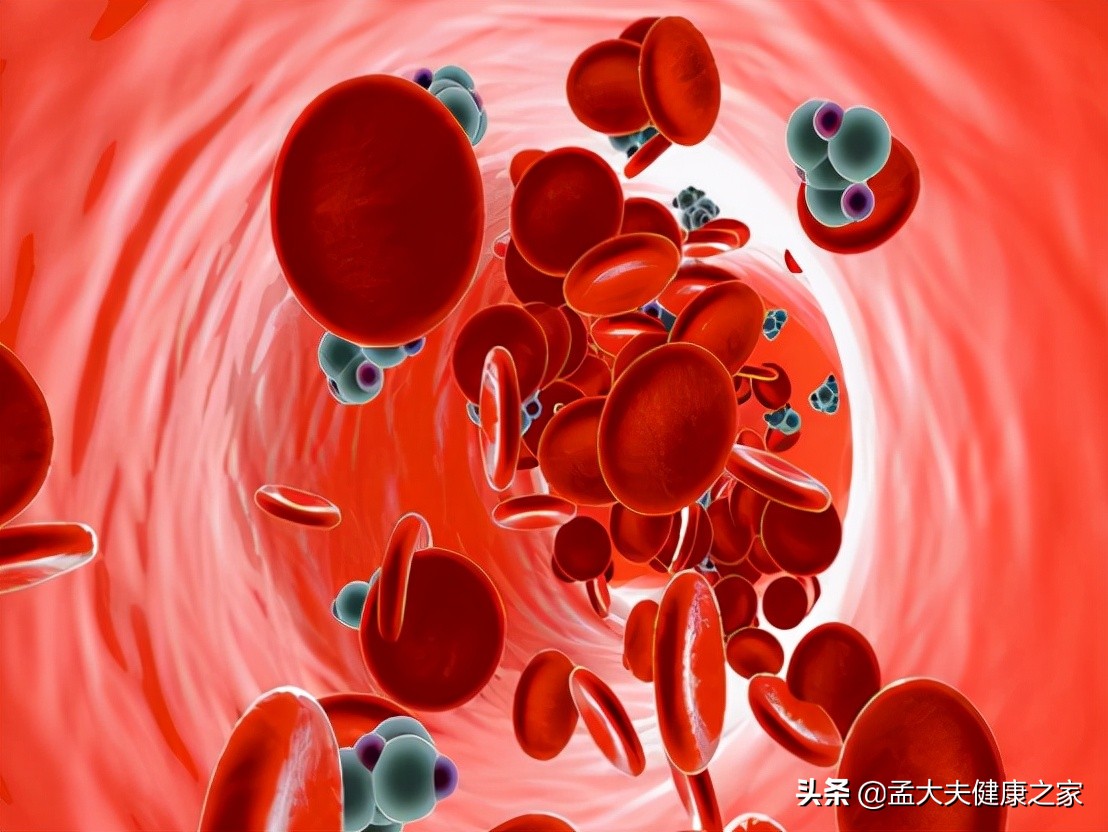 粥状动脉硬化防治指南：降脂治疗关键策略