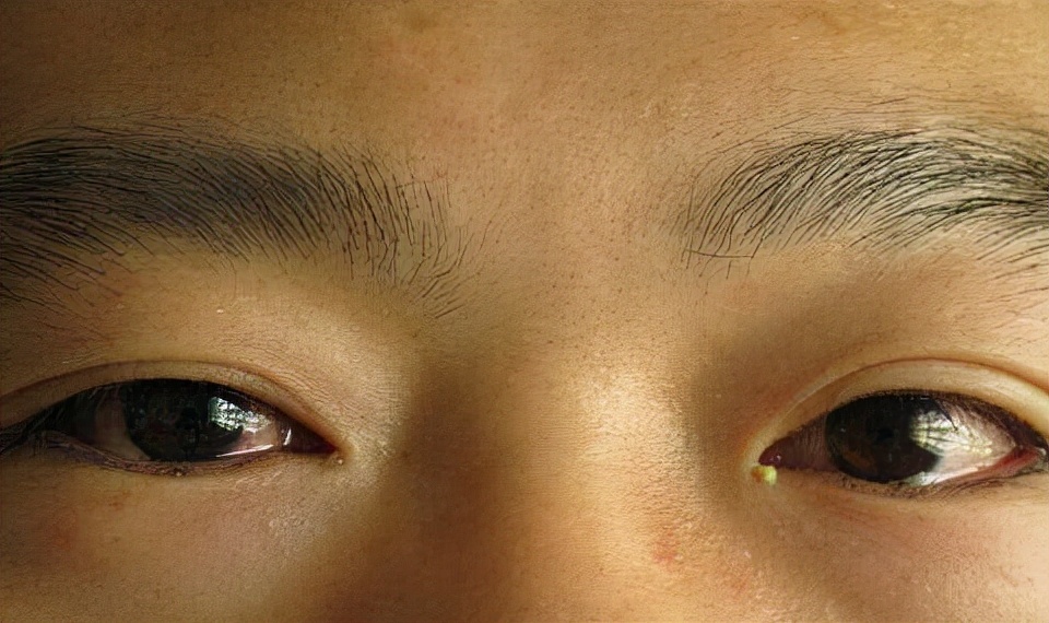 眼屎是怎么形成的，眼屎形成的原因？
