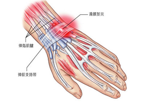 手大拇指下面的肌肉疼图片