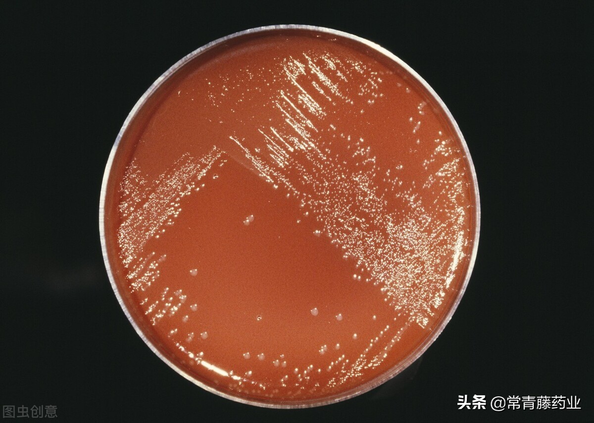 淋病要做什么检查，要怎么治疗以及要注意什么呢？一文说清楚