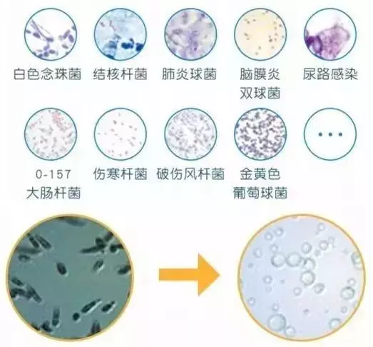 73岁老人发明洗衣神器，泡一泡衣服变干净，再不用担心衣服变形