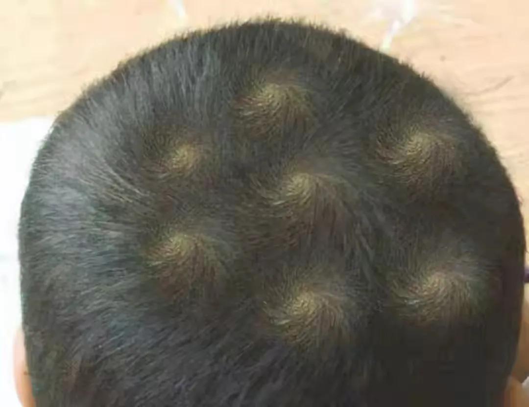 婴儿额头窄(你家娃有几个发旋) - 乐宝宝贝