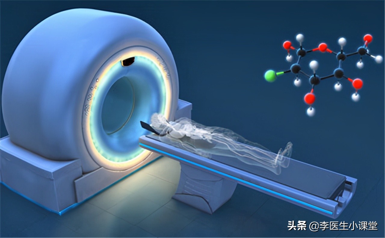 1万一次的PET-CT是什么？值得做吗？专家为你揭晓答案